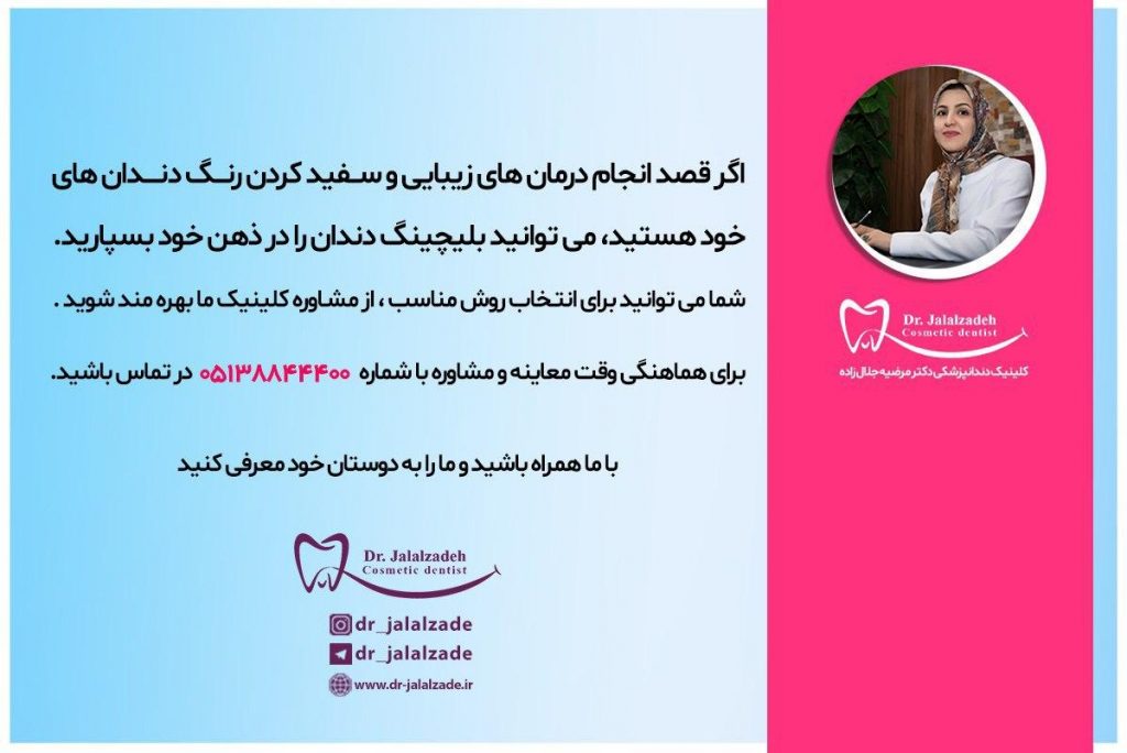 بلیچینگ دندان مشهد
