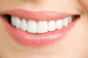 تفاوت لمینت و کامپوزیت ونیر
