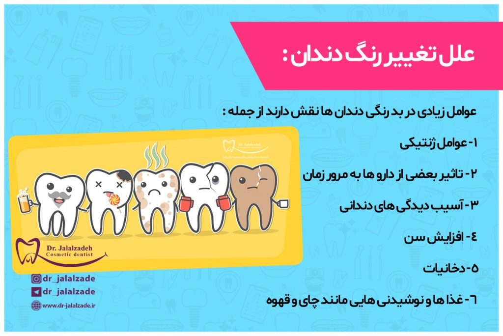 دلایل تغییر رنگ دندان