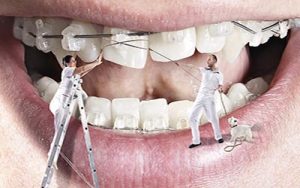 مراحل ارتودنسی ثابت