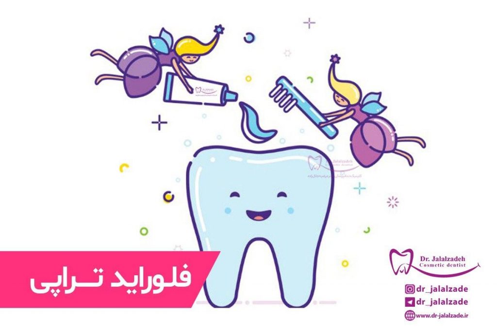 فلوراید-تراپی