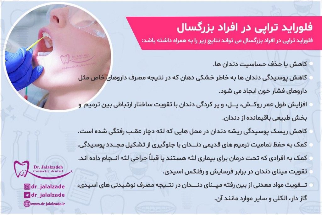 فلوراید تراپی بزرگسالان