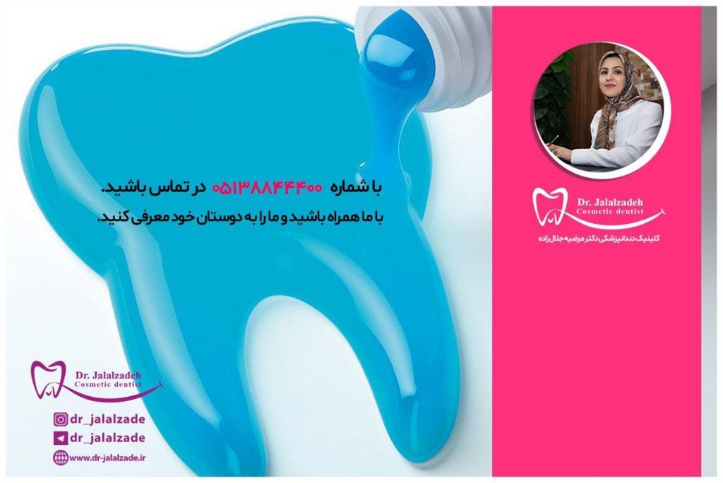 دکتر جلال زاده - فلوراید تراپی