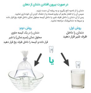 ضربه خوردن به دندان